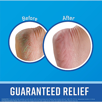 O'Keeffe's Healthy Feet Foot Cream (GORK0320005)