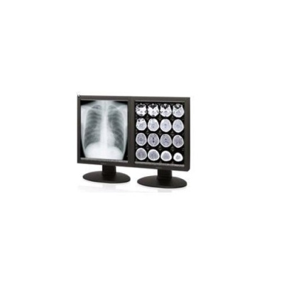 Totoku Medical Displays Sony 3mp Diagnostic Grayscale Lcd (LMDDM30)