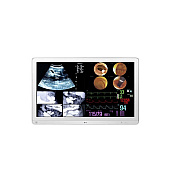 LG 32 Medical Ips 4k Surgical Monitor 3480x2160 Dp Fda Class I, 12g Sdi (32HL714SW)