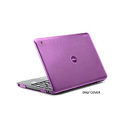 Ipearl Purple Mcover Case For 11.6 Dell C11 318 (MCOVERDC3180PUR)